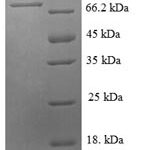 SDS-PAGE separation of QP6661 followed by commassie total protein stain results in a primary band consistent with reported data for E-Selectin / CD62e / SELE. These data demonstrate Greater than 90% as determined by SDS-PAGE.