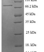 SDS-PAGE separation of QP6661 followed by commassie total protein stain results in a primary band consistent with reported data for E-Selectin / CD62e / SELE. These data demonstrate Greater than 90% as determined by SDS-PAGE.