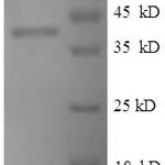 SDS-PAGE separation of QP6665 followed by commassie total protein stain results in a primary band consistent with reported data for Selenoprotein P. These data demonstrate Greater than 90% as determined by SDS-PAGE.