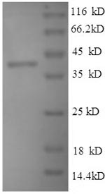 SDS-PAGE separation of QP6665 followed by commassie total protein stain results in a primary band consistent with reported data for Selenoprotein P. These data demonstrate Greater than 90% as determined by SDS-PAGE.