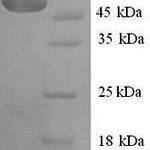 SDS-PAGE separation of QP6667 followed by commassie total protein stain results in a primary band consistent with reported data for SerpinA6 / CBG. These data demonstrate Greater than 90% as determined by SDS-PAGE.