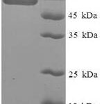 SDS-PAGE separation of QP6668 followed by commassie total protein stain results in a primary band consistent with reported data for SerpinB1 / ELANH2. These data demonstrate Greater than 90% as determined by SDS-PAGE.