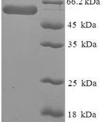 SDS-PAGE separation of QP6668 followed by commassie total protein stain results in a primary band consistent with reported data for SerpinB1 / ELANH2. These data demonstrate Greater than 90% as determined by SDS-PAGE.