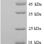 SDS-PAGE separation of QP6675 followed by commassie total protein stain results in a primary band consistent with reported data for SerpinF1 / PEDF. These data demonstrate Greater than 90% as determined by SDS-PAGE.