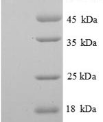 SDS-PAGE separation of QP6675 followed by commassie total protein stain results in a primary band consistent with reported data for SerpinF1 / PEDF. These data demonstrate Greater than 90% as determined by SDS-PAGE.