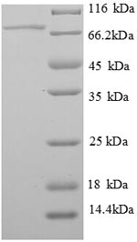 SDS-PAGE separation of QP6675 followed by commassie total protein stain results in a primary band consistent with reported data for SerpinF1 / PEDF. These data demonstrate Greater than 90% as determined by SDS-PAGE.
