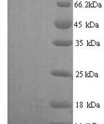 SDS-PAGE separation of QP6682 followed by commassie total protein stain results in a primary band consistent with reported data for Pulmonary surfactant-associated protein C. These data demonstrate Greater than 90% as determined by SDS-PAGE.