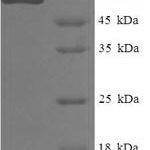 SDS-PAGE separation of QP6683 followed by commassie total protein stain results in a primary band consistent with reported data for gp100 / PMEL17 / SILV. These data demonstrate Greater than 90% as determined by SDS-PAGE.