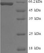 SDS-PAGE separation of QP6683 followed by commassie total protein stain results in a primary band consistent with reported data for gp100 / PMEL17 / SILV. These data demonstrate Greater than 90% as determined by SDS-PAGE.