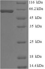 SDS-PAGE separation of QP6683 followed by commassie total protein stain results in a primary band consistent with reported data for gp100 / PMEL17 / SILV. These data demonstrate Greater than 90% as determined by SDS-PAGE.