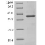 SDS-PAGE separation of QP6685 followed by commassie total protein stain results in a primary band consistent with reported data for Signal-regulatory protein beta-1. These data demonstrate Greater than 90% as determined by SDS-PAGE.