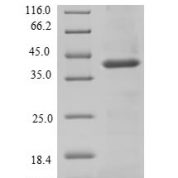 SDS-PAGE separation of QP6685 followed by commassie total protein stain results in a primary band consistent with reported data for Signal-regulatory protein beta-1. These data demonstrate Greater than 90% as determined by SDS-PAGE.