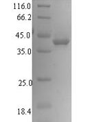 SDS-PAGE separation of QP6687 followed by commassie total protein stain results in a primary band consistent with reported data for SIRPG / SIRP gamma / CD172g. These data demonstrate Greater than 90% as determined by SDS-PAGE.