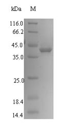 SDS-PAGE separation of QP6687 followed by commassie total protein stain results in a primary band consistent with reported data for SIRPG / SIRP gamma / CD172g. These data demonstrate Greater than 90% as determined by SDS-PAGE.