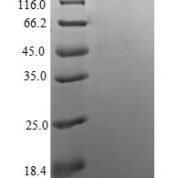 SDS-PAGE separation of QP6688 followed by commassie total protein stain results in a primary band consistent with reported data for Apoptosis regulatory protein Siva. These data demonstrate Greater than 90% as determined by SDS-PAGE.