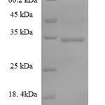 SDS-PAGE separation of QP6689 followed by commassie total protein stain results in a primary band consistent with reported data for S-phase kinase-associated protein 1. These data demonstrate Greater than 90% as determined by SDS-PAGE.