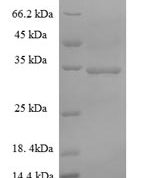 SDS-PAGE separation of QP6689 followed by commassie total protein stain results in a primary band consistent with reported data for S-phase kinase-associated protein 1. These data demonstrate Greater than 90% as determined by SDS-PAGE.