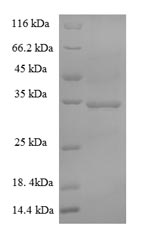 SDS-PAGE separation of QP6689 followed by commassie total protein stain results in a primary band consistent with reported data for S-phase kinase-associated protein 1. These data demonstrate Greater than 90% as determined by SDS-PAGE.