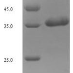 SDS-PAGE separation of QP6690 followed by commassie total protein stain results in a primary band consistent with reported data for Excitatory amino acid transporter 3. These data demonstrate Greater than 90% as determined by SDS-PAGE.