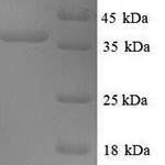 SDS-PAGE separation of QP6691 followed by commassie total protein stain results in a primary band consistent with reported data for Excitatory amino acid transporter 2. These data demonstrate Greater than 90% as determined by SDS-PAGE.