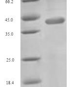 SDS-PAGE separation of QP6692 followed by commassie total protein stain results in a primary band consistent with reported data for Excitatory amino acid transporter 4. These data demonstrate Greater than 90% as determined by SDS-PAGE.