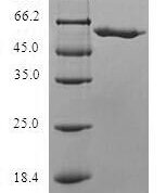 SDS-PAGE separation of QP6693 followed by commassie total protein stain results in a primary band consistent with reported data for SLC25A20. These data demonstrate Greater than 80% as determined by SDS-PAGE.