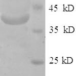 SDS-PAGE separation of QP6694 followed by commassie total protein stain results in a primary band consistent with reported data for Very long-chain acyl-CoA synthetase. These data demonstrate Greater than 90% as determined by SDS-PAGE.