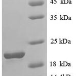 SDS-PAGE separation of QP6695 followed by commassie total protein stain results in a primary band consistent with reported data for Solute carrier family 41 member 2. These data demonstrate Greater than 90% as determined by SDS-PAGE.