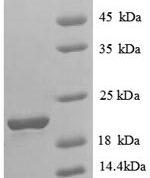SDS-PAGE separation of QP6695 followed by commassie total protein stain results in a primary band consistent with reported data for Solute carrier family 41 member 2. These data demonstrate Greater than 90% as determined by SDS-PAGE.
