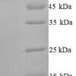 SDS-PAGE separation of QP6698 followed by commassie total protein stain results in a primary band consistent with reported data for SMARCA2. These data demonstrate Greater than 90% as determined by SDS-PAGE.