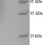 SDS-PAGE separation of QP6704 followed by commassie total protein stain results in a primary band consistent with reported data for SNCA / alpha-Synuclein. These data demonstrate Greater than 90% as determined by SDS-PAGE.