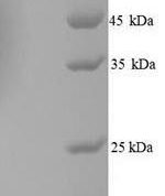 SDS-PAGE separation of QP6704 followed by commassie total protein stain results in a primary band consistent with reported data for SNCA / alpha-Synuclein. These data demonstrate Greater than 90% as determined by SDS-PAGE.
