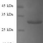 SDS-PAGE separation of QP6707 followed by commassie total protein stain results in a primary band consistent with reported data for Gamma-synuclein. These data demonstrate Greater than 90% as determined by SDS-PAGE.