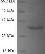 SDS-PAGE separation of QP6707 followed by commassie total protein stain results in a primary band consistent with reported data for Gamma-synuclein. These data demonstrate Greater than 90% as determined by SDS-PAGE.