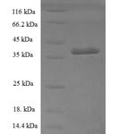 SDS-PAGE separation of QP6709 followed by commassie total protein stain results in a primary band consistent with reported data for Sorting nexin-20. These data demonstrate Greater than 90% as determined by SDS-PAGE.