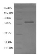 SDS-PAGE separation of QP6709 followed by commassie total protein stain results in a primary band consistent with reported data for Sorting nexin-20. These data demonstrate Greater than 90% as determined by SDS-PAGE.