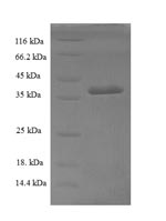 SDS-PAGE separation of QP6709 followed by commassie total protein stain results in a primary band consistent with reported data for Sorting nexin-20. These data demonstrate Greater than 90% as determined by SDS-PAGE.