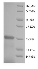 SDS-PAGE separation of QP6711 followed by commassie total protein stain results in a primary band consistent with reported data for Suppressor of cytokine signaling 1. These data demonstrate Greater than 91.1% as determined by SDS-PAGE.