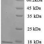 SDS-PAGE separation of QP6716 followed by commassie total protein stain results in a primary band consistent with reported data for Sortilin. These data demonstrate Greater than 90% as determined by SDS-PAGE.