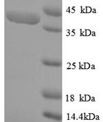 SDS-PAGE separation of QP6720 followed by commassie total protein stain results in a primary band consistent with reported data for SPEG / APEG-1. These data demonstrate Greater than 90% as determined by SDS-PAGE.