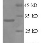 SDS-PAGE separation of QP6722 followed by commassie total protein stain results in a primary band consistent with reported data for Osteopontin / SPP1 / ETA-1. These data demonstrate Greater than 90% as determined by SDS-PAGE.