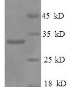 SDS-PAGE separation of QP6722 followed by commassie total protein stain results in a primary band consistent with reported data for Osteopontin / SPP1 / ETA-1. These data demonstrate Greater than 90% as determined by SDS-PAGE.