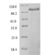 SDS-PAGE separation of QP6725 followed by commassie total protein stain results in a primary band consistent with reported data for Spectrin alpha chain