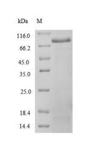 SDS-PAGE separation of QP6725 followed by commassie total protein stain results in a primary band consistent with reported data for Spectrin alpha chain