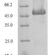 SDS-PAGE separation of QP6727 followed by commassie total protein stain results in a primary band consistent with reported data for SRI / Sorcin. These data demonstrate Greater than 80% as determined by SDS-PAGE.