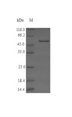 SDS-PAGE separation of QP6729 followed by commassie total protein stain results in a primary band consistent with reported data for Serine racemase. These data demonstrate Greater than 90% as determined by SDS-PAGE.
