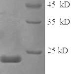 SDS-PAGE separation of QP6730 followed by commassie total protein stain results in a primary band consistent with reported data for Sex-determining region Y protein. These data demonstrate Greater than 90% as determined by SDS-PAGE.