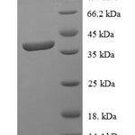 SDS-PAGE separation of QP6735 followed by commassie total protein stain results in a primary band consistent with reported data for STAT3. These data demonstrate Greater than 90% as determined by SDS-PAGE.