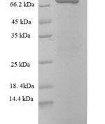 SDS-PAGE separation of QP6737 followed by commassie total protein stain results in a primary band consistent with reported data for Stress-induced-phosphoprotein 1. These data demonstrate Greater than 90% as determined by SDS-PAGE.