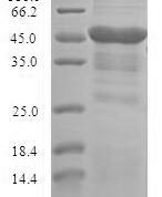 SDS-PAGE separation of QP6740 followed by commassie total protein stain results in a primary band consistent with reported data for STOM / EPB72. These data demonstrate Greater than 90% as determined by SDS-PAGE.